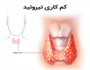 پروانه ای اثرگذار در افزایش سوخت و ساز بدن