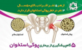 استخوان های شما گرانبها هستند، از آن ها به دقت محافظت کنید...